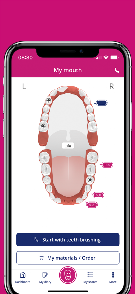 Mobile app interface showing an interactive visual map of teeth with health scores and dental risk indicators