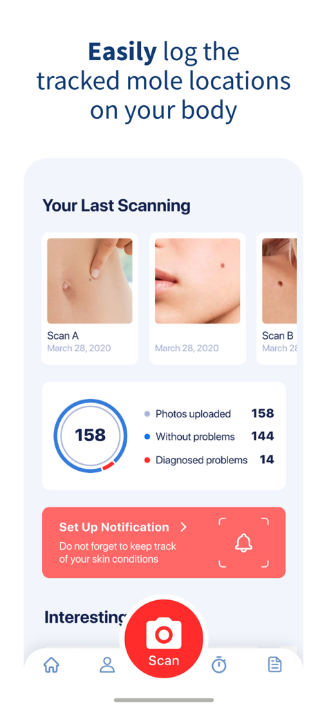 Interfaccia di un'app mobile che mostra la cronologia del monitoraggio dei nei e le statistiche di scansione della pelle