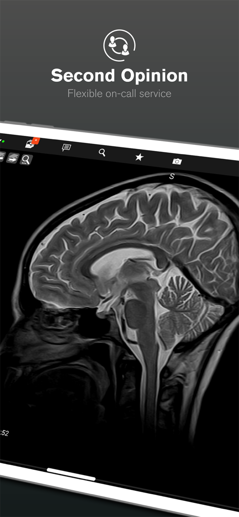 Interface de l'application mRay affichant une IRM cérébrale sagittale pour un deuxième avis médical