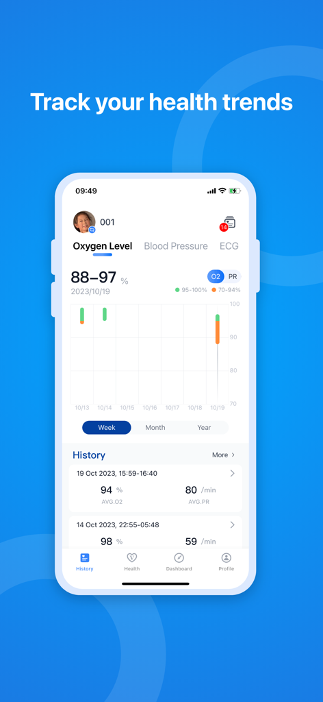 ViHealth - Screenshot of the ViHealth app interface showing oxygen level trends and historical health data on a smartphone.