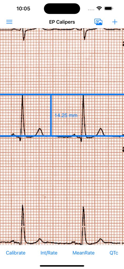 Digital calipers on an electrocardiogram strip measuring intervals in the EP Calipers app