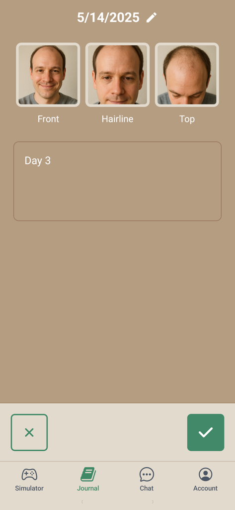 A journal entry in the Hairgen app showing front, hairline, and top photos of a man's head to track hair loss progress.