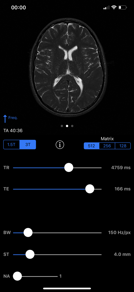 MRIcontrast Pro - Medical App | MWM