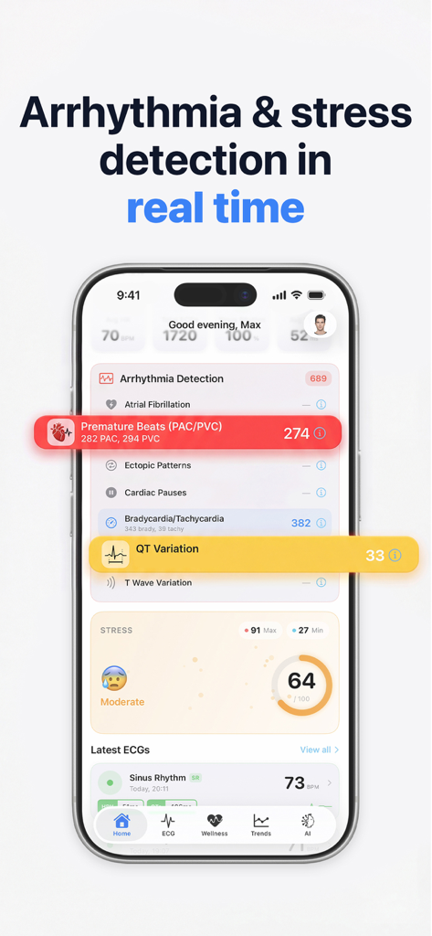 HeartLab app dashboard displaying real time arrhythmia and stress detection with ECG analysis