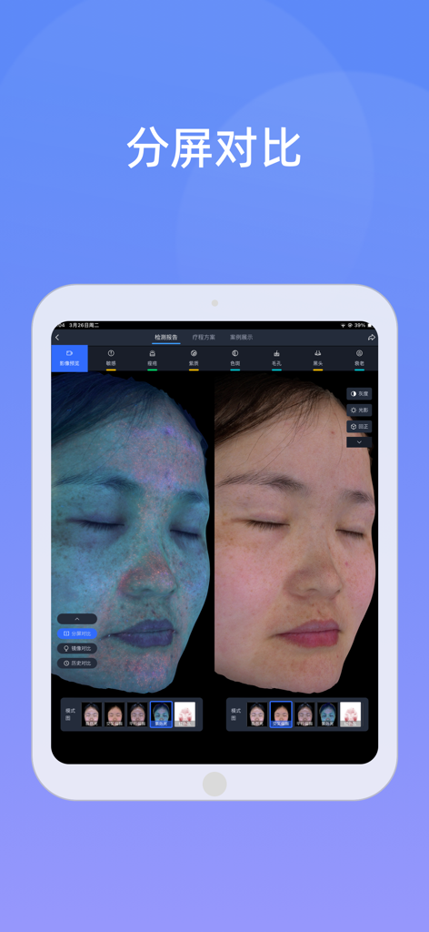 优颜3D - Youyan 3D 앱에서 일반 및 진단 조명을 보여주는 분할 화면 피부 분석 비교