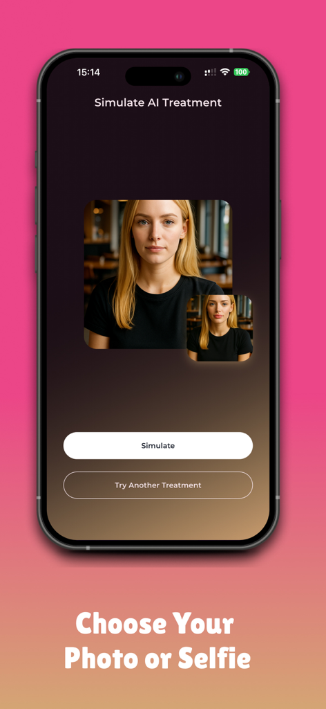 AI 보톡스 및 필러 시뮬레이션을 위한 사진 또는 셀카 선택 옵션을 보여주는 모바일 앱 인터페이스.