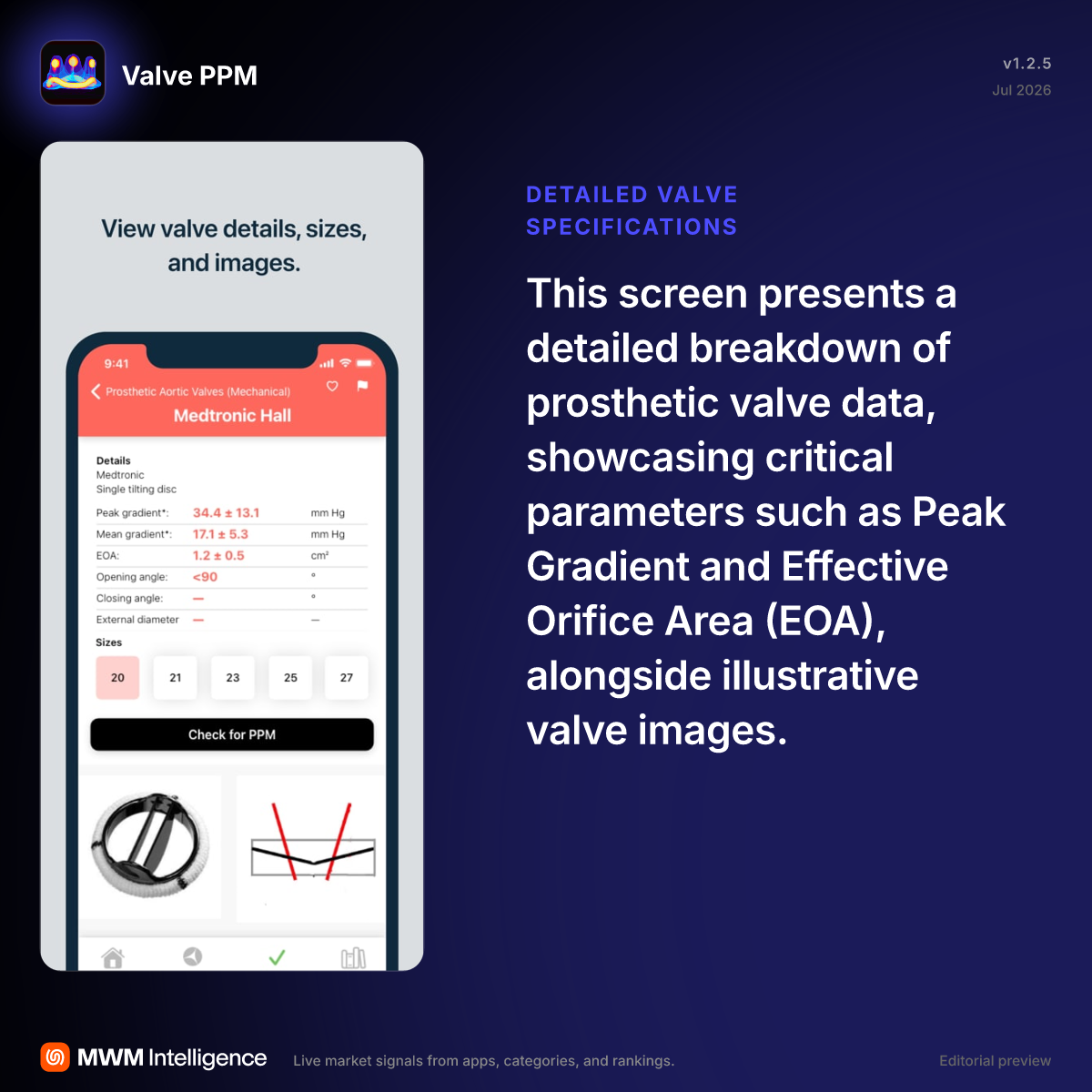 Valve PPM - Medical App | MWM