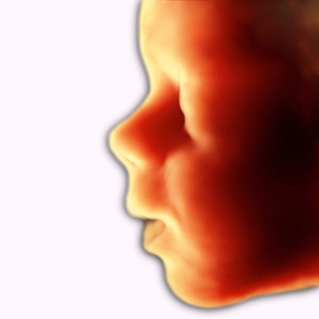 ScanBaby learn baby ultrasound