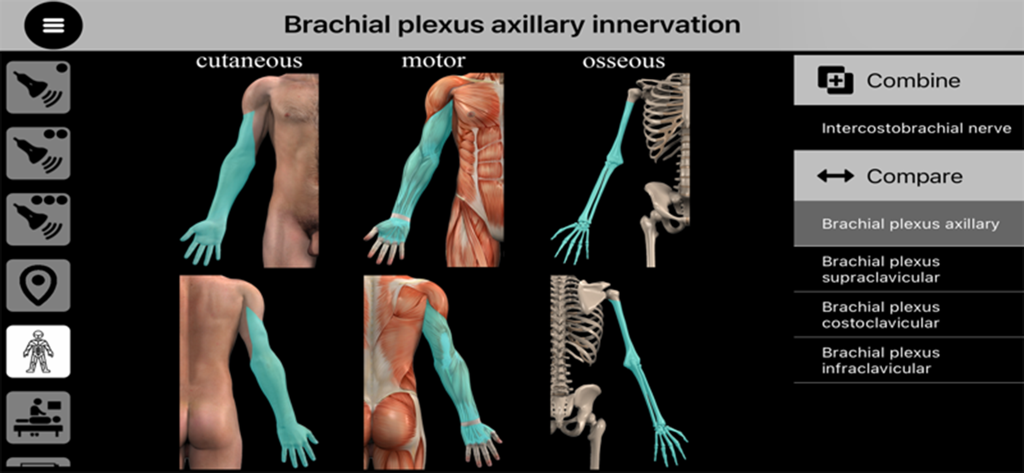 AnSo Pro - Tela do aplicativo AnSo Pro exibindo a inervação axilar do plexo braquial com mapas cutâneos, motores e ósseos