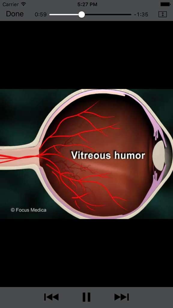 Cross-section diagram of the human eye highlighting the vitreous humor