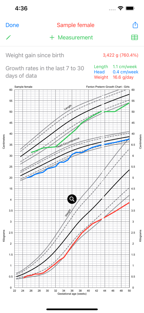 Preterm Growth Tracker - A detailed preterm growth chart for a female infant showing curves for length, head circumference, and weight based on gestational age