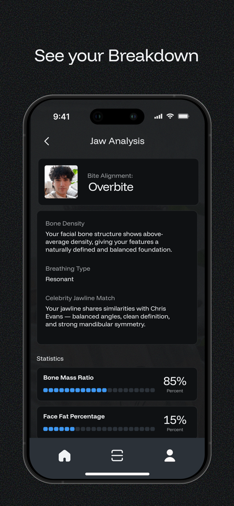 AscendMax - Become Hot - AscendMax 앱의 턱 분석 화면은 얼굴 뼈 밀도 및 지방 백분율 통계를 표시합니다.