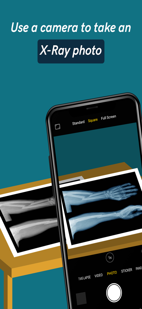 X-Ray Camera- X Ray Vision sca - Smartphone usando la cámara para escanear una imagen de Rayos X simulada de un brazo.