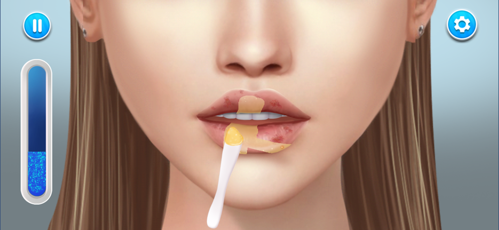 ASMR Hospital : Doctor Games - Close up gameplay showing ointment being applied to damaged lips in ASMR Hospital doctor game
