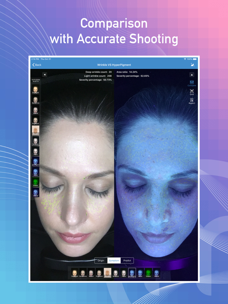Meicet - Meicet iPad app showing a side-by-side comparison of wrinkle analysis and hyperpigmentation detection on a woman's face
