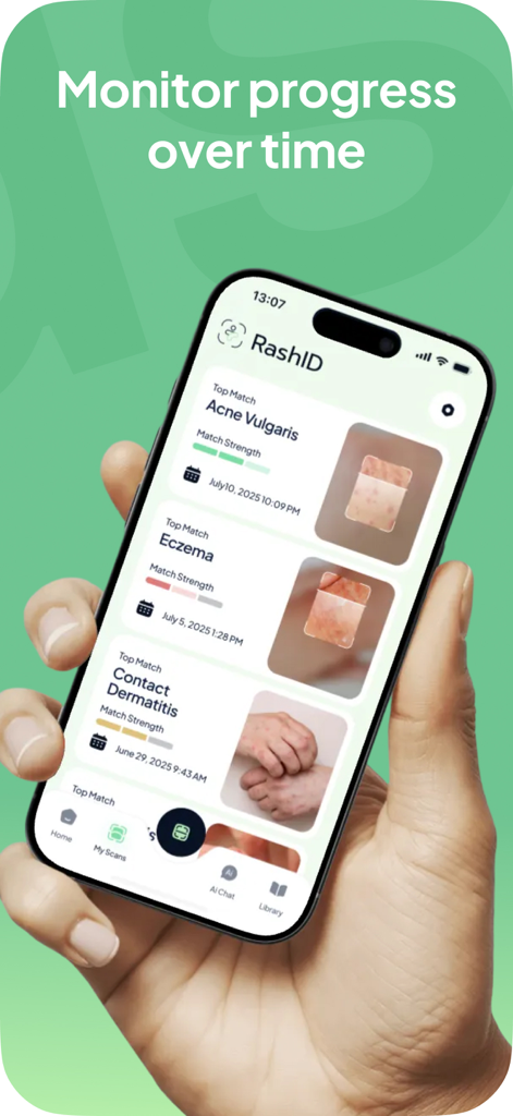 Rash ID: Skin Rash Identifier - Hand holding a phone showing the Rash ID app scan history to monitor skin condition progress over time