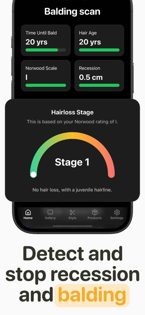 Interfaccia dell'app Crown AI che mostra un rapporto di scansione della perdita di capelli con classificazione della perdita di capelli di Stadio 1 e metriche della Scala Norwood.