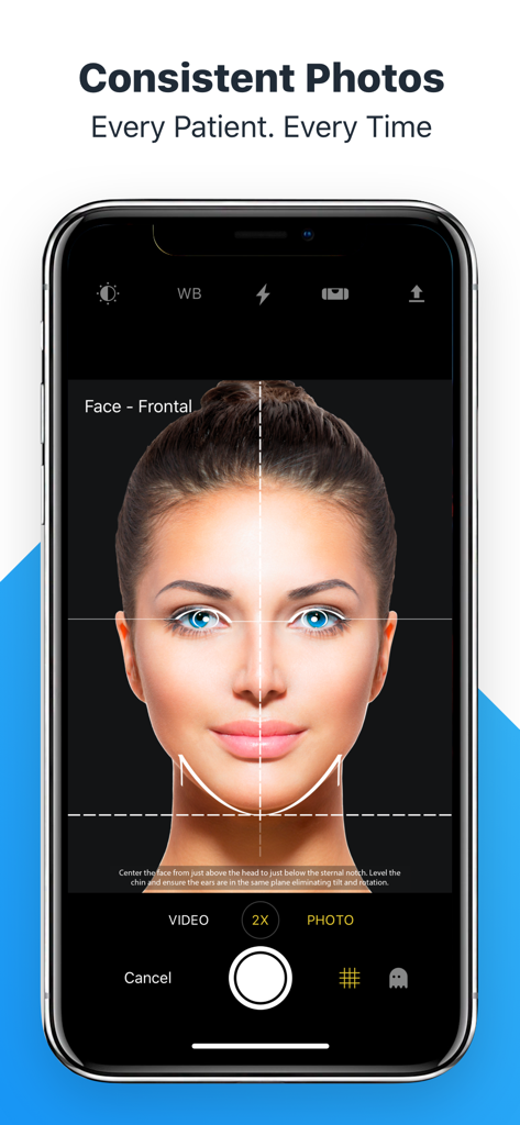 Interface do aplicativo RxPhoto mostrando guias de alinhamento facial para fotografia clínica consistente de pacientes