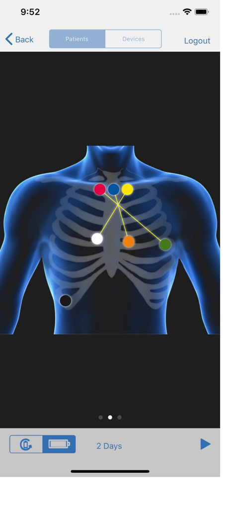 SEER Simulator - A simulation of electrode placement positions on a chest for a SEER 1000 Holter recorder hookup