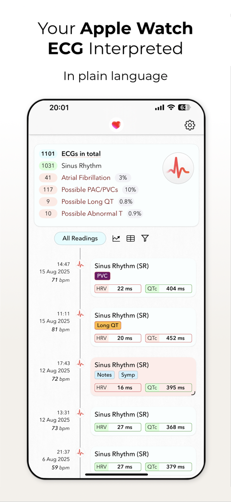 ECG+ | Your Watch ECG Reader - Mobile app interface showing interpreted heart health data from an Apple Watch