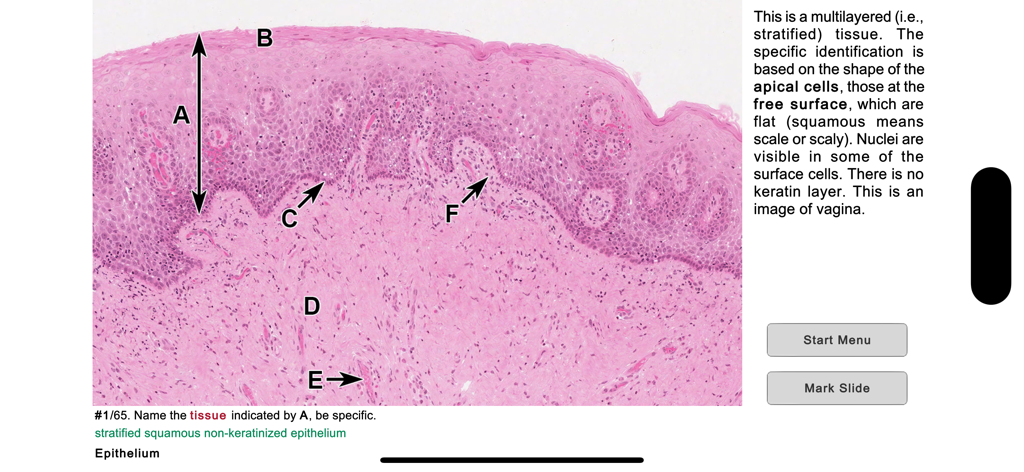 Histo! - Mikroskopische Aufnahme von mehrschichtigem Plattenepithel in der medizinischen Lern-App Histo.