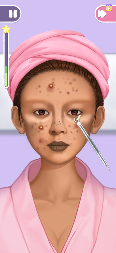 A gameplay screenshot of Skincare Time Makeover ASMR showing a facial pimple extraction process using a specialized tool