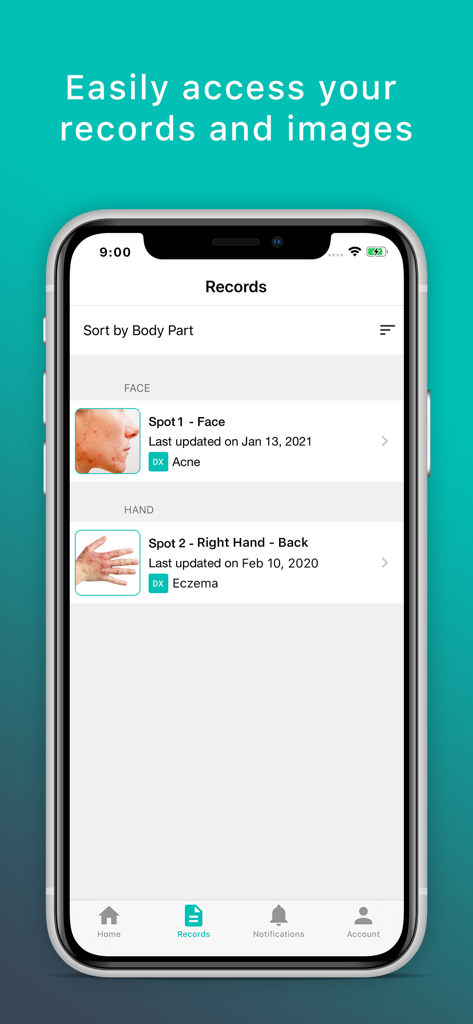 Skin App - Online Dermatology - Skin App-Aufzeichnungen-Bildschirm, der Fotos von Hauterkrankungen und Diagnosen für Akne und Ekzeme zeigt