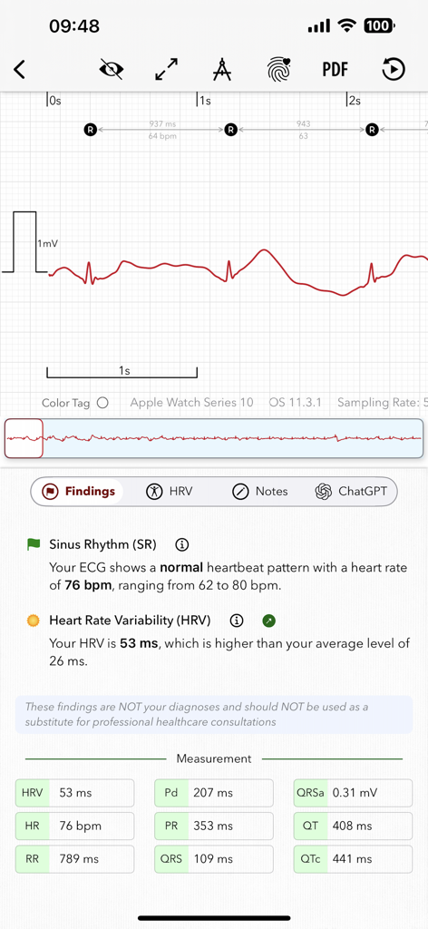 ECG+ | Your Watch ECG Reader - ECG app dashboard showing heart rate variability analysis and detailed heartbeat wave metrics