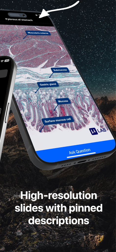 High-resolution histology slide of the stomach pylorus with labeled tissue layers