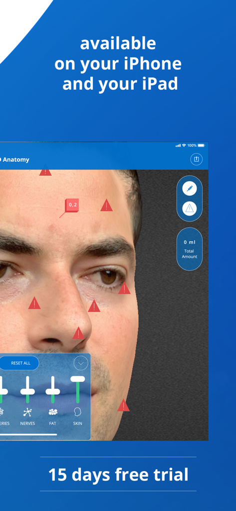NextMotion 3D - 주입 위험 구역 및 레이어 컨트롤이 있는 얼굴 해부학을 보여주는 NextMotion 3D 앱 인터페이스