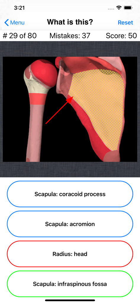 Anatomy Shoulder Quiz - A shoulder anatomy quiz question in a mobile app featuring a 3D model of the scapula with a red arrow pointing to the infraspinous fossa.
