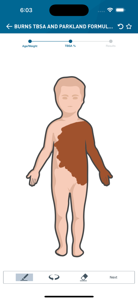 NSW Trauma - Interactive burns calculator interface in the NSW Trauma app showing a child body chart with marked burn areas for TBSA assessment.