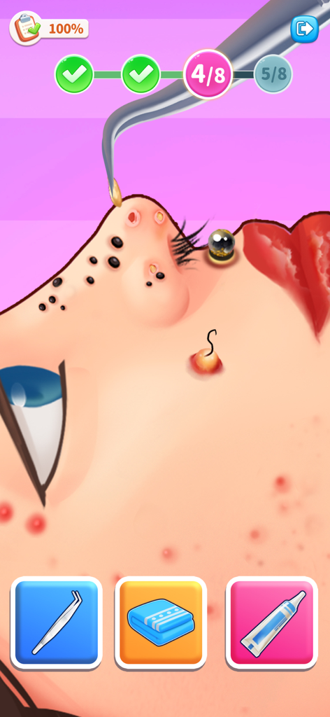 Match Villa™: Makeup ASMR - Uma visão de close-up de um personagem recebendo um tratamento de cuidados com a pele facial com pinças em Match Villa Makeup ASMR.