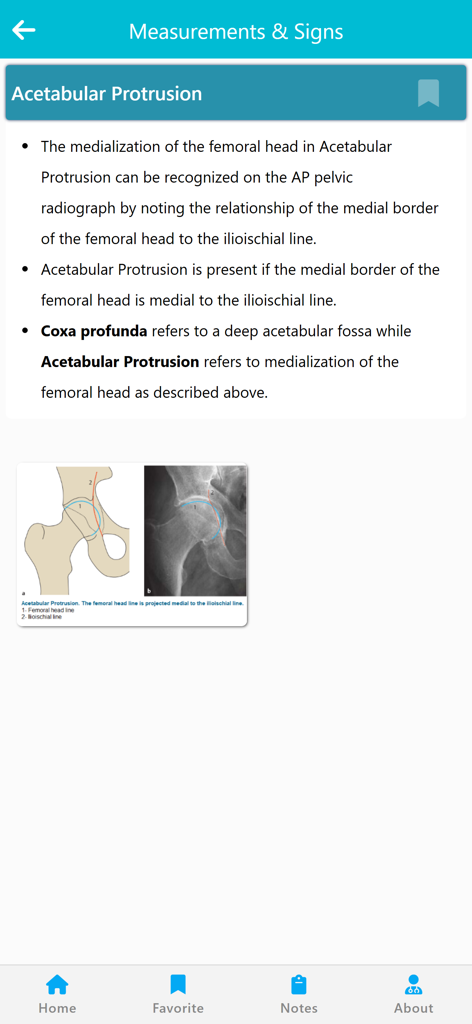 Orthopedic Signs & Angles - Medical App | MWM