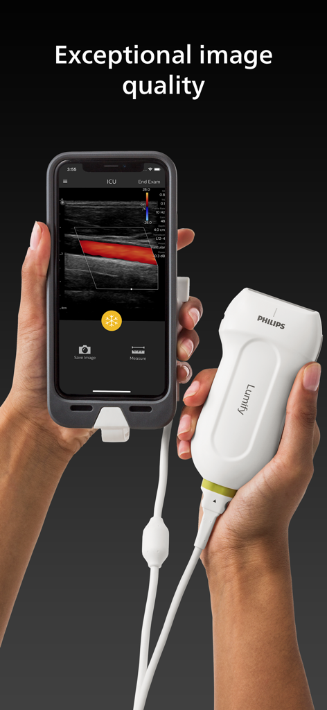 Philips Lumify handheld ultrasound probe and mobile app displaying medical scan results on a smartphone