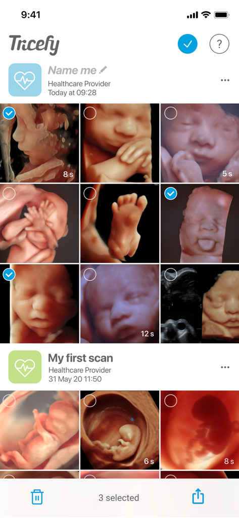 Gallery of 3D ultrasound images in the Tricefy for Patients app