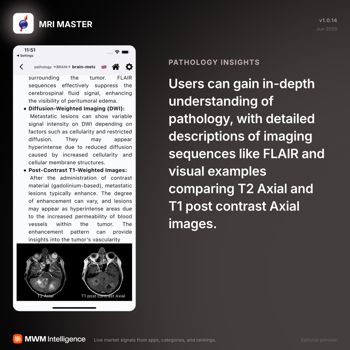 MRI MASTER - Education App | MWM