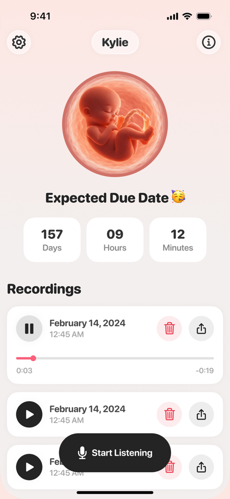 Baby Heartbeat Monitor - Molio - 赤ちゃんの心音モニターMolioアプリの画面。胎児のイラスト、出産予定日のカウントダウン、保存された心音の録音記録が表示されています。