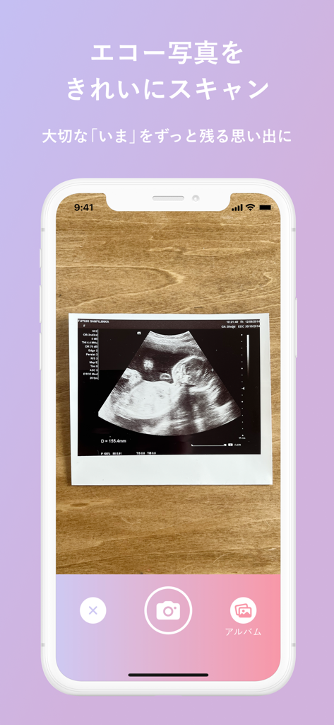 A smartphone screen scanning a baby ultrasound photo to create a digital memory