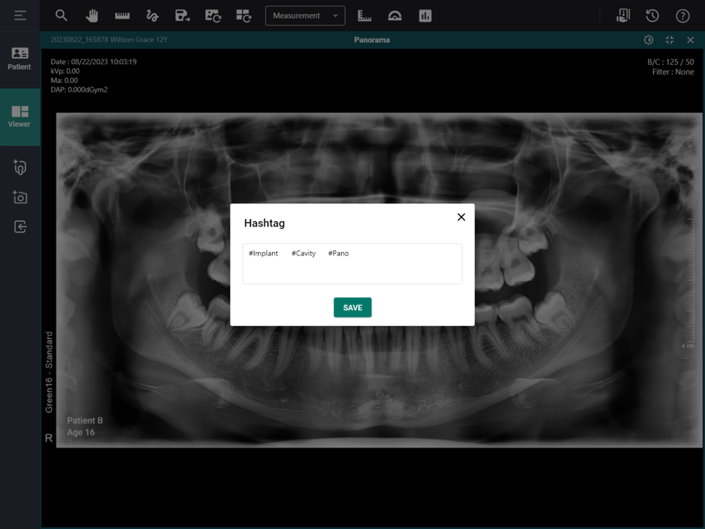 Un rayo X dental panorámico mostrado en la interfaz de EzDent Web con una ventana emergente de selección de etiquetas para categorización clínica.