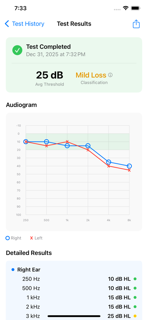 Screen showing hearing test results with a professional audiogram graph and mild loss classification