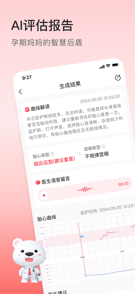 A mobile app interface showing an AI-generated medical report for fetal heart rate monitoring with data charts and doctor comments.