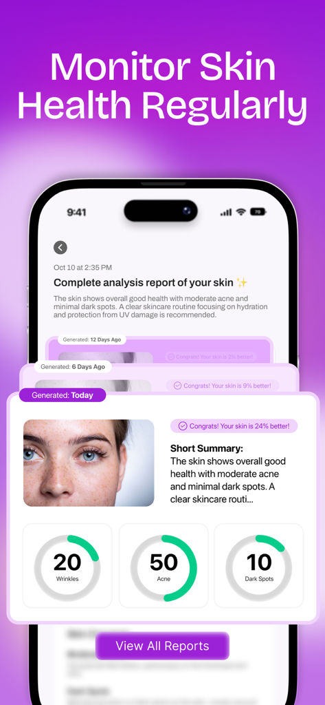 Glow Up & Skin Care AI: MAXX - Mobile app interface showing AI skin health analysis report and progress tracking with metrics for acne and wrinkles