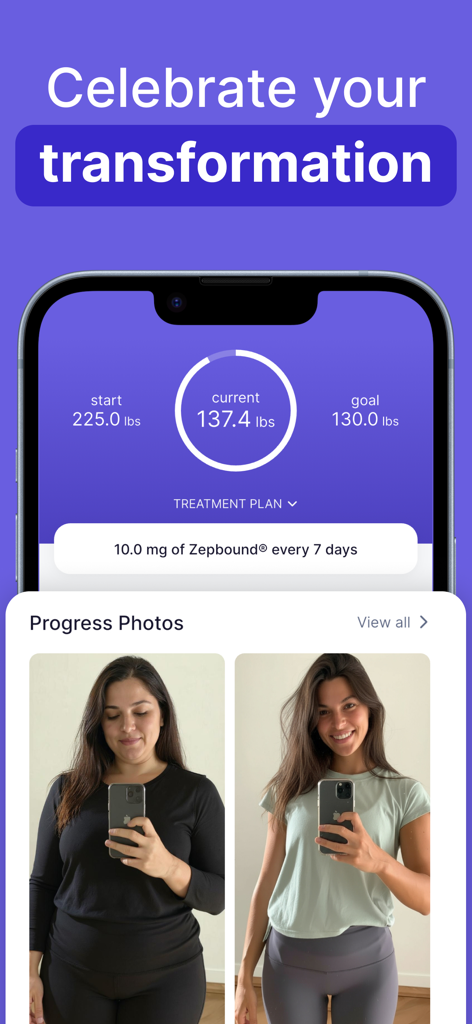 Zepbound Tracker App, die den Fortschritt des Gewichtsverlusts und Vorher-Nachher-Fotos zeigt