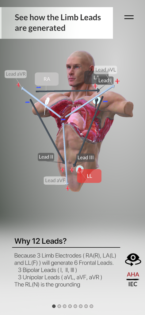 3D anatomical model illustrating the generation of ECG limb leads from electrode placements