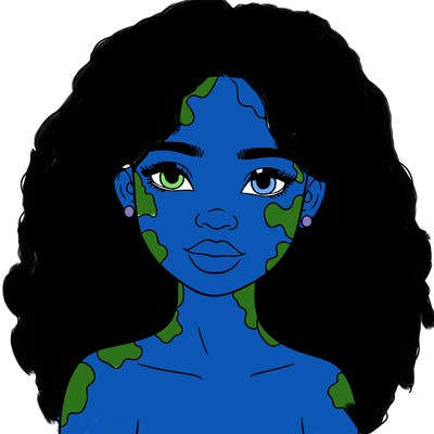 beautiful black girl with vitiligo