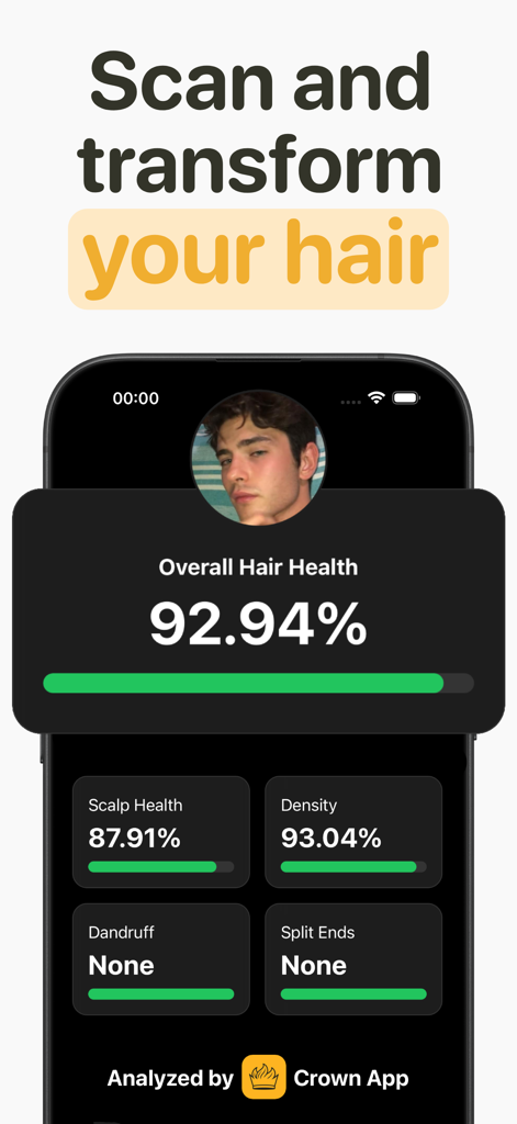 Interfaccia dell'app Crown AI che mostra il punteggio generale della salute dei capelli e l'analisi della salute del cuoio capelluto per un utente maschile