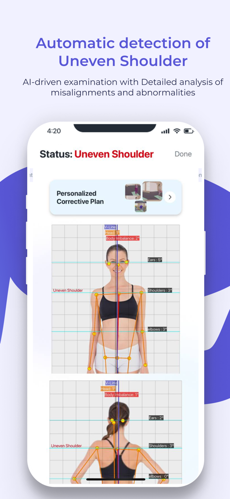 Tela de análise de postura por IA mostrando a detecção de ombros desiguais com grade de alinhamento digital e medições.