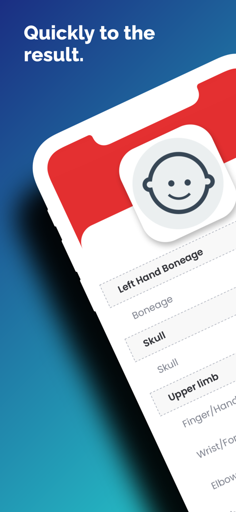 Pedbone App-Oberfläche mit Kategorien für pädiatrische Radiographie-Referenzen wie Knochenalter Schädel und obere Extremität