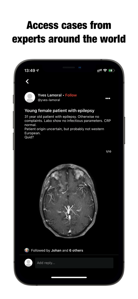 Collective Minds - Application Collective Minds montrant un cas de radiologie clinique avec une IRM cérébrale pour une collaboration d'experts.